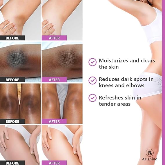 🌺 Luce Axilas y Zonas Íntimas sin Manchas — Resultados desde la 1ª Semana