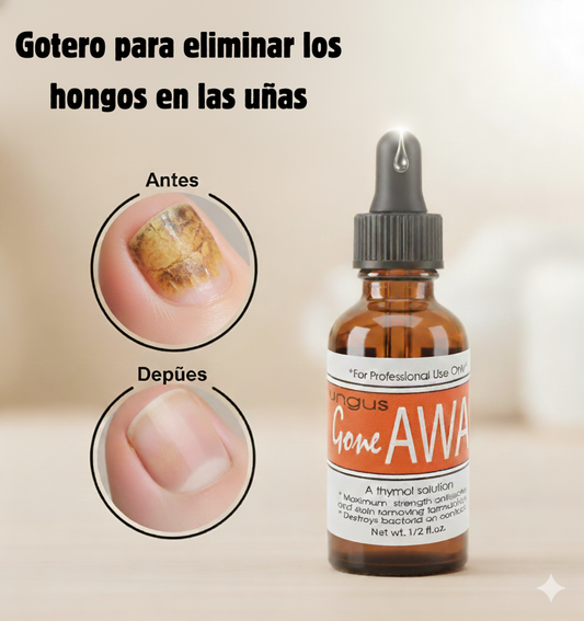 Gotero Antihongos para Uñas | Pago al Recibir y Envío Gratis RD