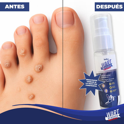 Elimina Verrugas al Instante con Wart Remover Ointment – Piel Suave y Sin Marcas